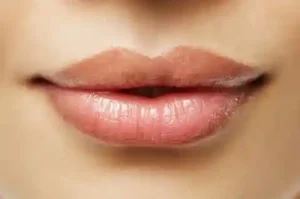 aumento de labios bucaramanga
