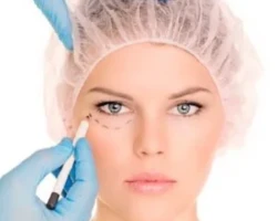 Blefaroplastia Blefaroplastia Bucaramanga