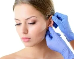 Otoplastia Otoplastia Bucaramanga